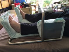 The bottom half of two legs on a bed.  They are resting in a customised metal splint with cushioning. 